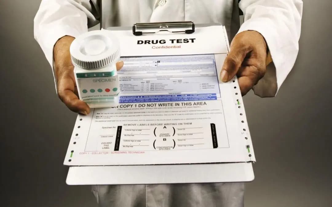 How Can Your Employment Drug Test Go Smoothly